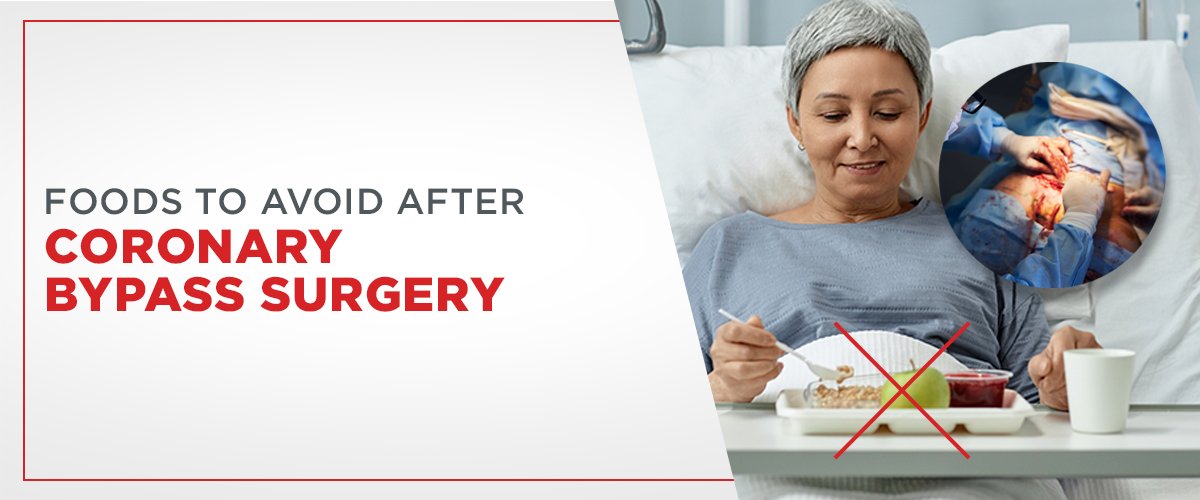 Foods to Avoid After Coronary Bypass Surgery