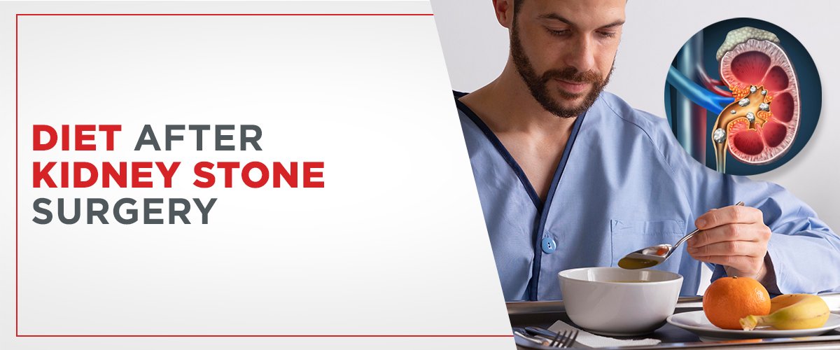 Diet After Kidney Stone Surgery: A Complete Guide